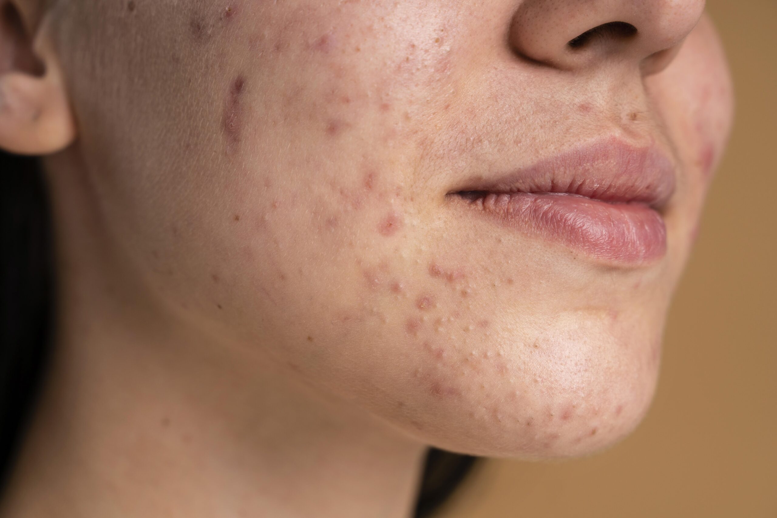 Understanding Common Skin Problems and How to Treat Them